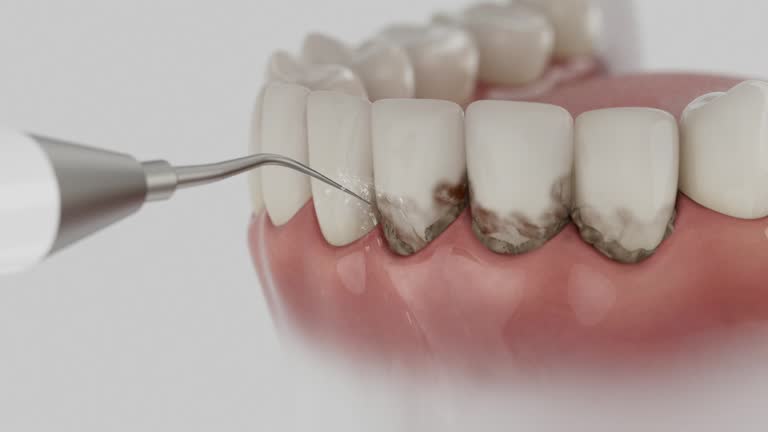 Reliable Dental contractor in Ovid, MI by Smile Center Dentistry